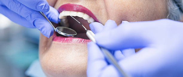 Best Broken or Chipped Tooth Repair in Stanford, KY